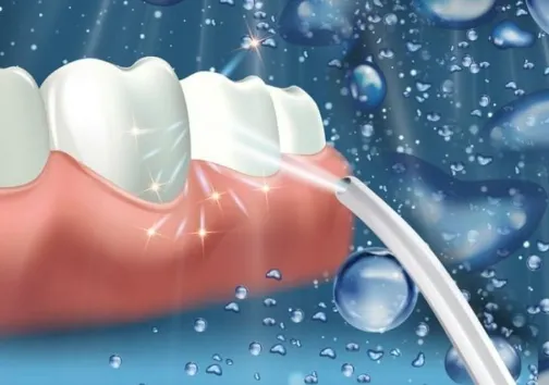  Oral Irrigator 